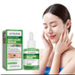Salicylic Acid Facial Serum Oil Control Pore Care