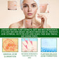 Salicylic Acid Facial Serum Oil Control Pore Care