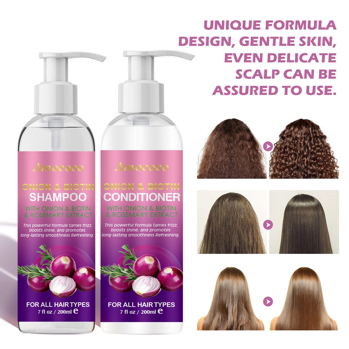 Onion Biotin Rosemary Shampoo Conditioner Set